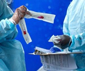 Uno de los informes de los Centros para el Control y la Prevención de Enfermedades (CDC, por sus siglas en inglés) examinó a niños con covid-19 que necesitaron hospitalización. AP.