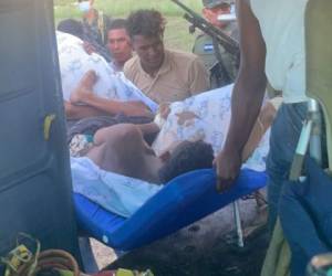 Cuatro misquitos resultaron con heridas de gravedad por lo que serán trasladados a Tegucigalpa donde serán operados.