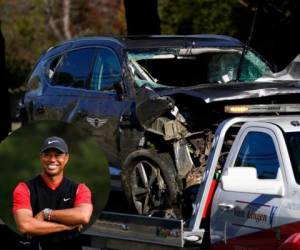 Woods sufrió lesiones graves en las piernas cuando la camioneta que conducía se volcó en una carretera del condado de Los Ángeles. Foto:AP