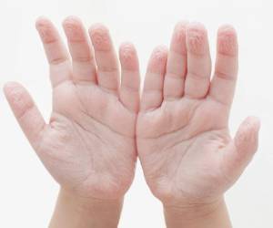 Bastan cinco minutos en el agua para la que las yemas de los dedos y las palmas de las manos se arruguen. Foto Shutterstock