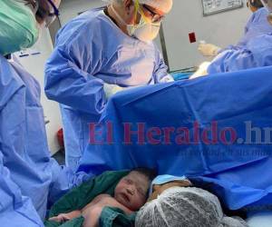 Las niñas nacieron en una clínica privada de San Pedro Sula.