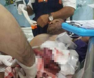 La persona herida fue trasladada al Hospital Escuela Universitario (UNAH).