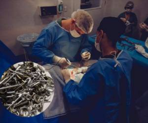 El hospital transmitió a medios locales una fotografía de una bandeja quirúrgica con los clavos y tornillos. FOTO DE REFERENCIA.