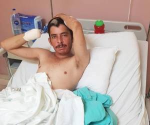 El hondureño perdió la mano y las piernas al caer de 'La Bestia'. Foto: Cortesía Ignacio Sánchez / Facebook.