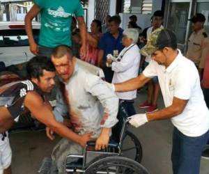 La tarde de este domingo se registró un fatal accidente en la colonia Buenos Aires, Concepción del Sur, Santa Bárbara. Una mototaxi en la que viajaban 12 personas perdió el control y se estrelló en una vivienda, dejando como resultado 3 personas muertas y nueve heridas.