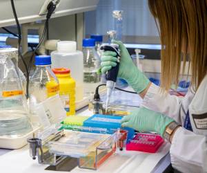 El hígado recordó, cumple funciones esenciales como el control de niveles de azúcar, el metabolismo de hormonas y la eliminación de desechos de la sangre.