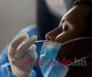 Los expertos aseguran que si las personas completan el esquema de vacunación solo presentarán síntomas leves si se infectan.