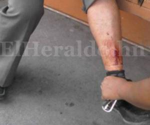 El golpe le abrió la rodilla por lo que tuvo que recibir atención médica.
