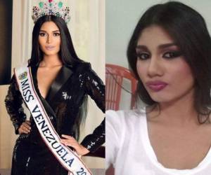 En redes sociales circulan fotos que demuestran que se ha hecho algunos retoques estéticos. Fotos Instagram| El Farandi