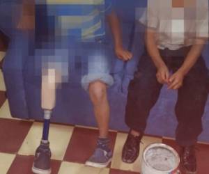 Uno de los niños rescatados no tiene una pierna, por ende utiliza una prótesis, y era precisamente de lo que se aprovechaban las personas que los obligaban a mendigar. (Foto: El Heraldo Honduras)