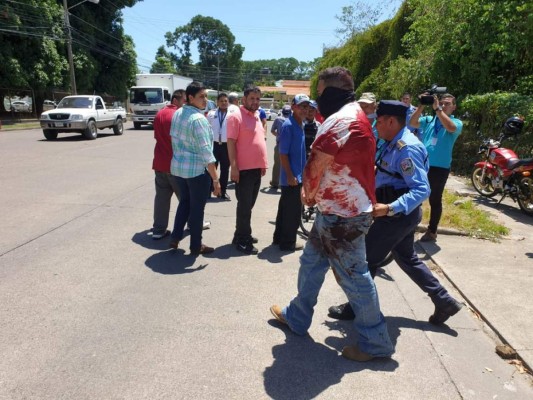 Uno de los heridos en el doble crimen que ocurrió en la ciudad de La Ceiba, usaba un tapaboca. Foto: Cortesía.