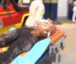 El herido fue trasladado hasta el Hospital Escuela. Foto: Cortesía.