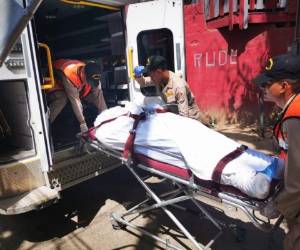 Carlos Alexis Moya Castro, de 32 años de edad, tenía quemaduras de segundo y tercer grado.