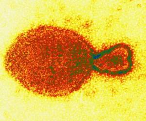 Se sabe que el henipavirus es detectado por medio de pruebas en la garganta.