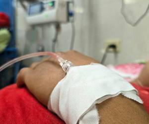 Cascabel, tamagás y barba amarilla figuran entre las serpientes que han mordido a 125 personas atendidas este año en el Hospital Escuela.