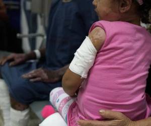 Los médicos hacen un llamado a los padres de familia a que no permitan que sus hijos manipulen cohetes durante las festividades dicembrinas.