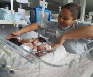 Jennifer Pamela Martínez, madre de las dos niñas, les brinda a diario su amor y ternura a sus retoños, ella las alimenta y en ocasiones las carga, le pide a Dios que las niñas sobrevivan.