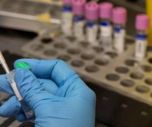 El hombre dio positivo simultáneamente a covid-19, viruela del mono y VIH.