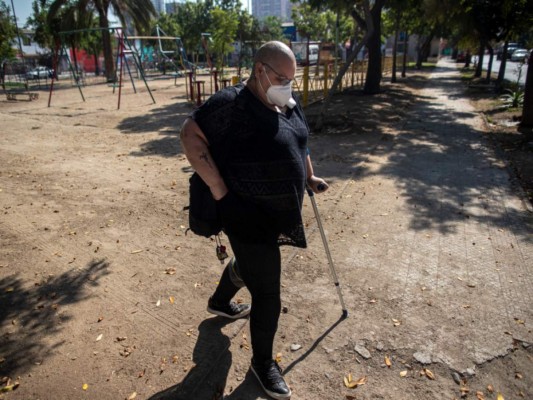 Cecilia Heyder, una activista chilena por el derecho a una muerte digna y que sufre de cáncer metastásico, lupus y un trastorno sanguíneo. Foto: Agencia AP.