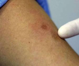 Las autoridades informaron que se está investigando si este hombre tiene relación con el primer caso registrado en el país.