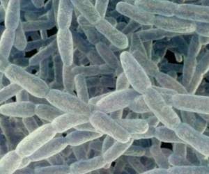 La bacteria legionella fue identificada como la causa de un brote de neumonía bilateral en Argentina.