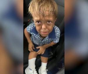 Quaden Bayles (9) conmovió al mundo al compartir un video donde llora al contar el acoso que sufre por su condición de acondroplasia.