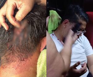 Atacaron con bombas molotov a militantes del Partido Nacional tras salir del escrutinio especial en el CLE.