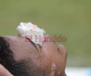 Samuel Chama Córdova abandonó el campo tras recibir un fuerte pelotazo en el rostro. El número 3 del Marathón salió con la nariz rota. Fotos Grupo OPSA