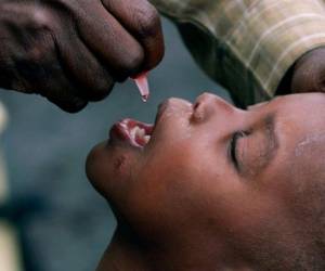 La polio es una enfermedad altamente infecciosa que se propaga a través del agua o alimentos contaminados y suele afectar a niños menores a 5 años. Foto: AP.