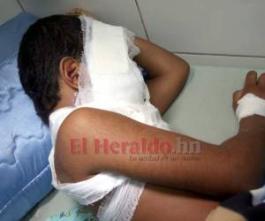 Uno de los afectados se recupera en la Sala de Observaciones del Instituto Hondureño de Seguridad Social (IHSS).