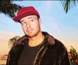 James comenzó en la música tras haberse fracturado en varias ocasiones. Foto: AFP