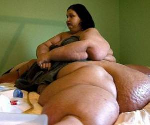 El caso de la mexicana Mayra Rosales es un claro ejemplo de superación. En el 2005 fue considerada “la mujer más obesa del mundo” y actualmente su realidad es totalmente distinta. Fotos cortesía Facebook @texasvalleygirl2/Mayra Rosales
