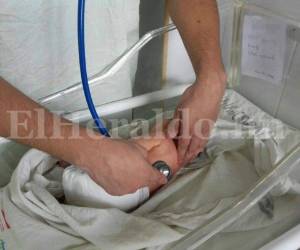 En lo que va del año ya se reportan 33 casos en el país.