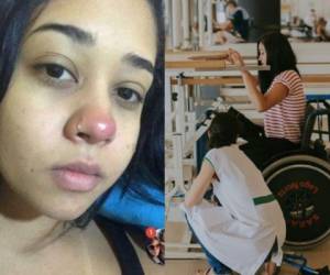 Al ponerse un piercing, Layane adquirió una bacteria que ingresó a su torrente sanguíneo Fotos Instagram @layaanedias