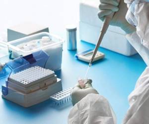 El gremio de microbiólogos exige que se abastezca de insumos para aumentar el procesamiento de pruebas PCR diarias para los sospechosos de covid-19, ya que actualmente la capacidad es baja.