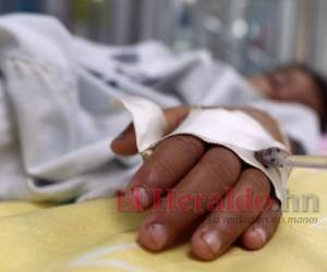 A la fecha más de 140 muertes ha provocado el dengue en el país. Fotos: Archivo El Heraldo Honduras.