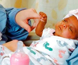La familia de la bebé autorizó que se compartiera esta historia, pero solicitó permanecer en el anonimato, según el hospital. | Foto: AP.