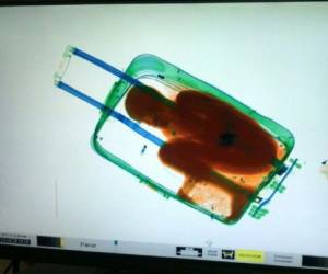 El 7 de mayo de 2015, una pequeña maleta transportada por una joven marroquí pasó por los rayos X del escáner en un puesto fronterizo de Ceuta, dejando boquiabiertos a los agentes de la Guardia Civil que descubrieron la silueta de Adou Ouattara acurrucado en posición fetal. Foto: AFP