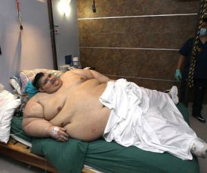 En 2017, Franco, de entonces 32 años, pesaba cerca de 595 kilos.