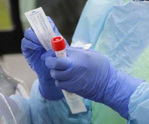 El 4 de abril se compraron las pruebas PCR a una empresa de Corea del Sur a un costo de 7.50 dólares cada una.
