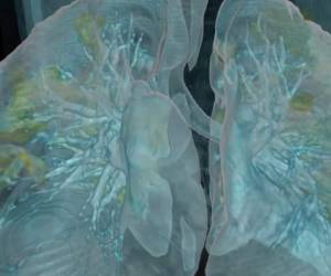 Un especialista comparte la representación virtual de los pulmones de un hombre con coronavirus para crear conciencia sobre sus efectos. Foto George Washington University Hospital