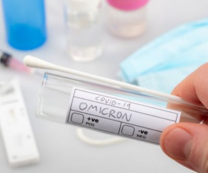 Las pruebas son revisadas en el Instituto Conmemorativo Gorgas de Panamá.