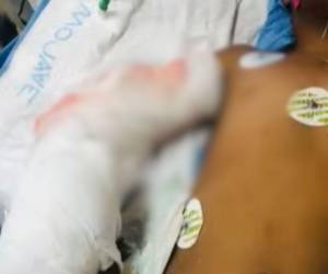 Familiares piden ayuda para poder cubrir los gastos de la cirugía del menor y de su madre.