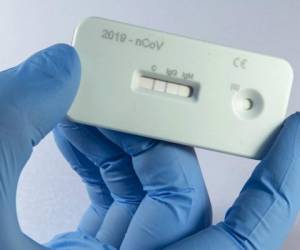 Actualmente Honduras no está realizando pruebas rápidas, solo PCR. Foto: AP