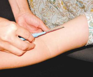 El implante anticonceptivo es una varita diminuta y delgada del tamaño de un fósforo. Foto EL HERALDO