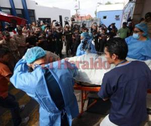 Los bomberos fueron llevados a México para someterlos a varias cirugías. Foto: EL HERALDO