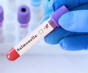 La marca QuaKer Oats procedió a retirar del mercado los productos detectados que estaban contaminados con salmonela, tras la advertencia de la Administración de Alimentos y Medicamentos FDA.