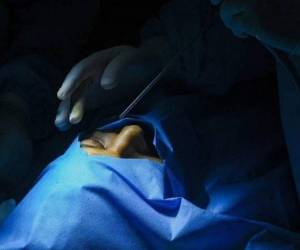 Esta afección ha desatado mucha preocupación a nivel mundial luego de la alta incidencia de casos registrados en la India, en donde se han registrado ya varias muertes a causa de esta infección.