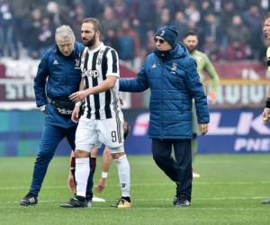 Higuaín quedó tendido en el campo dolorido durante tres minutos después de un contacto cerca del arco con el portero de Torino. Foto: AP