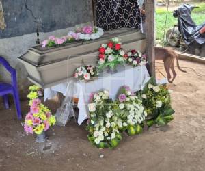 Yamileth permaneció 16 días internada en el Hospital Mario Catarino Rivas, en San Pedro Sula.